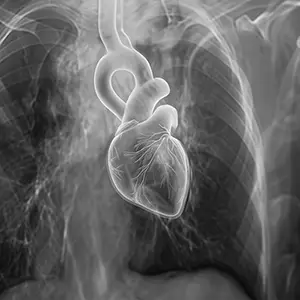 Início 7 img-cardiopatias-congenitas-alberth-tavares-cardiologista-pediatrico-brasilia-df